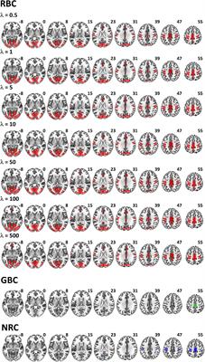Regularized Functional Connectivity in Schizophrenia